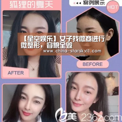 【星空娱乐】女子找微商进行微整形，容貌全毁